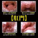 Precious:２穴 ぷにぷに 淫妹名器　　（中型ホール） 